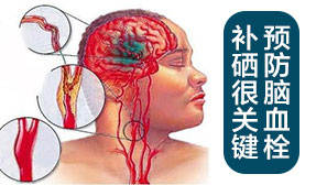 預防腦血栓 補硒很關(guān)鍵