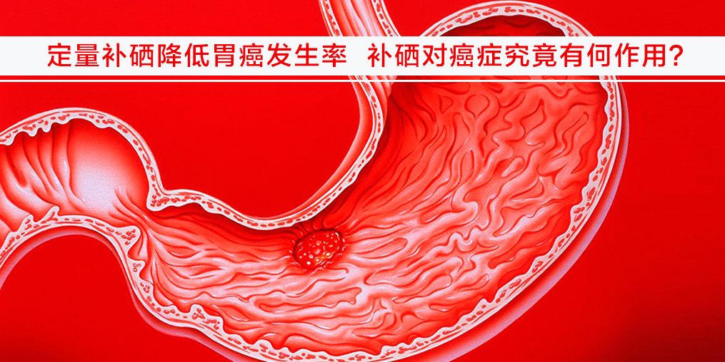 遠離胃癌不難，改變不良習(xí)慣外多補硒