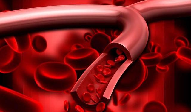 老人血脂稠危害大，多補硒有助降血脂