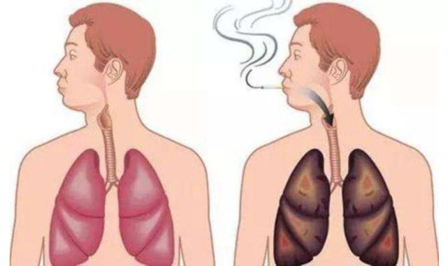 補硒，給你的肺部洗洗澡吧