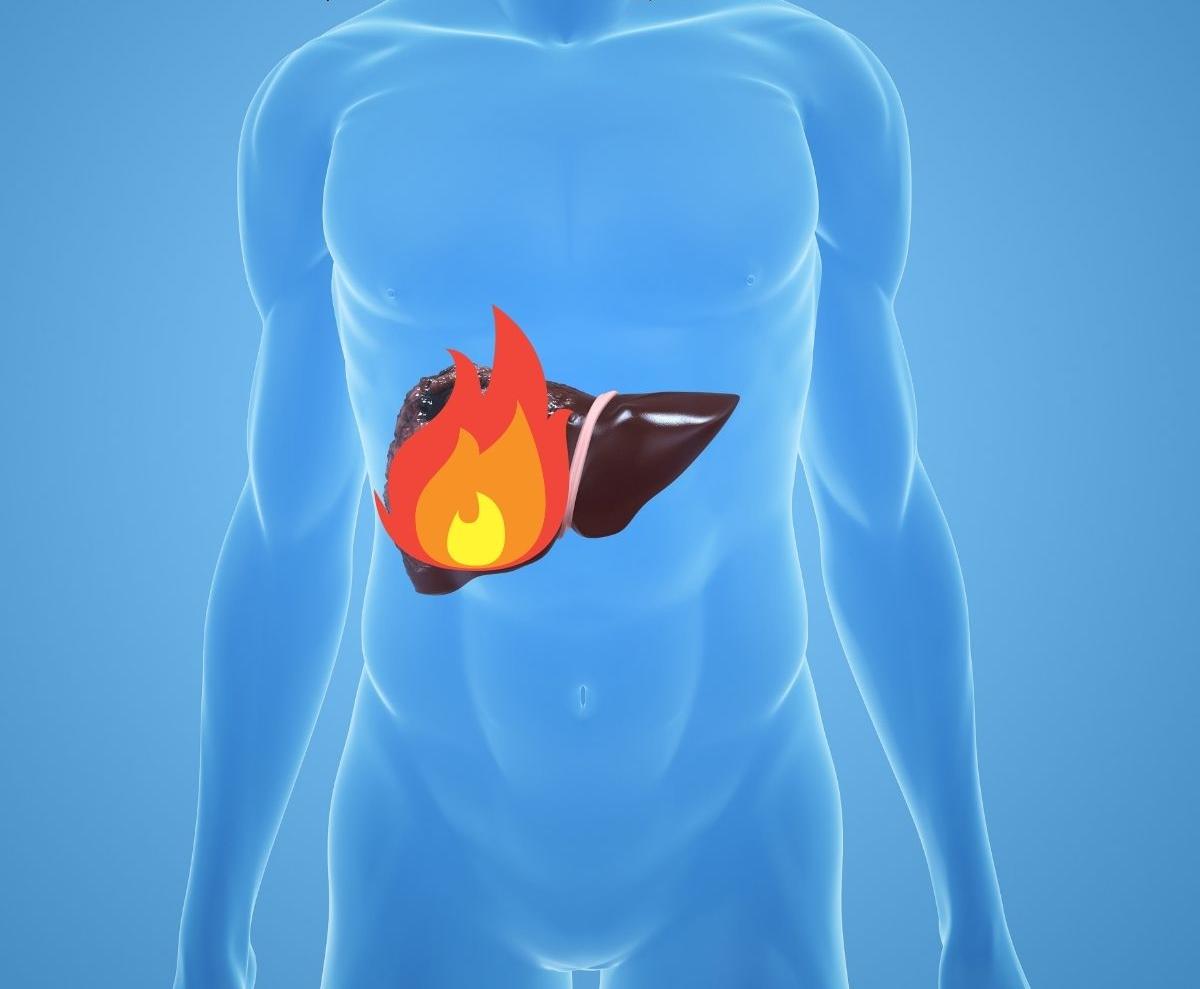 肝火旺怎么辦？